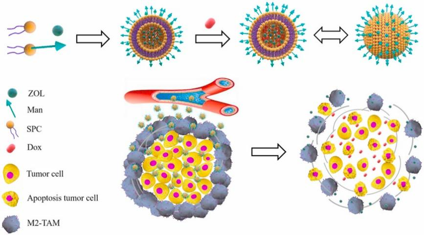 Man-LP@ZOL/DOX developed by Cai. could deplete M2-tumor-associated macrophages to enhance anti-tumor effect of doxorubicin on TNBC